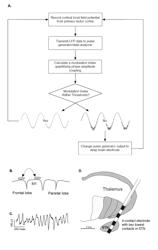 Methods and Systems for Treating Neurological Movement Disorders