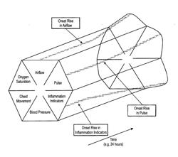 System and Method for Detecting a Baseline Gradient