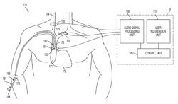 Method for locating a catheter tip using audio detection