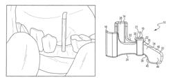 Sensor positioning and stabilizing device