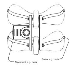 Advanced Intra-spinal Decompression Implant