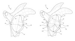 Circular glenoid method for shoulder arthroplasty