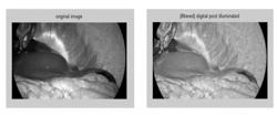 Endoscopic Video System with Dynamic Contrast and Detail Enhancement