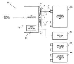 RF energy delivery system and method