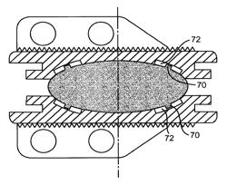 Intervertebral prosthetic disc