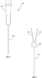 Systems and methods for in vivo measurement of interstitial biological activity, processes and/or compositions