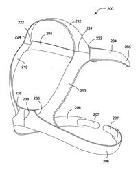 ULTRASONIC WELDING OF FABRICS FOR SLEEP APNEA TREATMENT