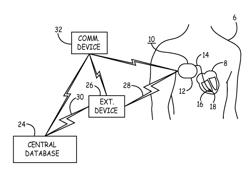 Heart failure patient management using an implantable monitoring system