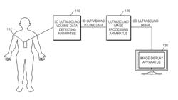 Method and apparatus for processing ultrasound image