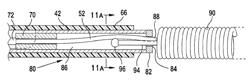 System and method for mechanically positioning intravascular implants