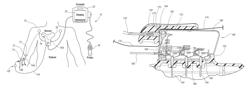 System for placement of a catheter including a signal-generating stylet