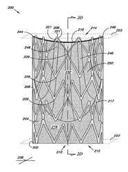 Venous Valve Apparatus, System, and Method