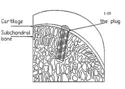 Solid forms for tissue repair