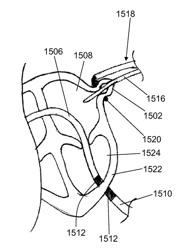 Methods and devices for accessing and delivering devices to a heart