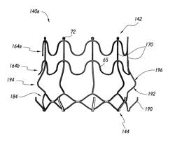 Vascular implant