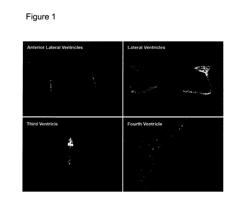 Gene therapy for lysosomal storage diseases