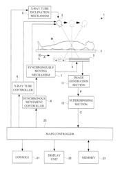 Radiographic apparatus