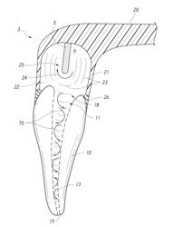 APPARATUS AND METHODS FOR CLEANING TEETH AND ROOT CANALS