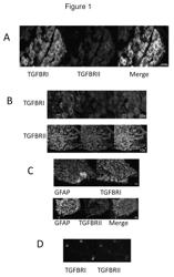 Use of transforming growth factor-beta neutralizing antibodies and fusion proteins thereof in treating pain