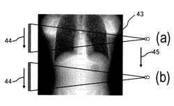 MEDICAL IMAGE PROCESSING DEVICE AND MEDICAL IMAGE PROCESSING METHOD