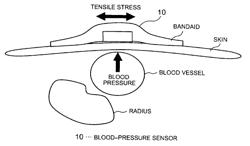 BLOOD-PRESSURE SENSOR