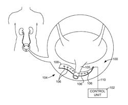 IMPLANTABLE ELECTRODE ASSEMBLY