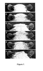 Use of 2,5-dihydroxybenzene derivatives for treating dermatitis