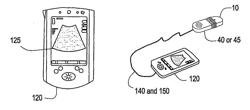 METHOD AND SYSTEM FOR PDA-BASED ULTRASOUND