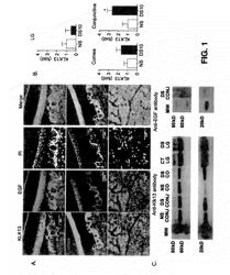 KLK-13 antibody inhibitor for treating dry eye