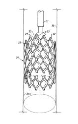 Expandable tubing and method