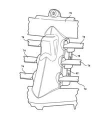 Bracket-active grille and actuator