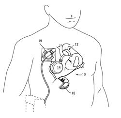 Methods, Systems, and Devices Relating to a Fail-Safe Pump for a Medical Device