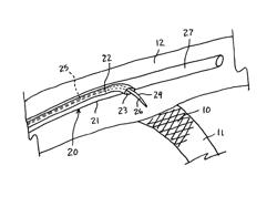 Side port catheter device and method for accessing side branch occlusions