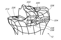 Methods and apparatus for performing knee arthroplasty