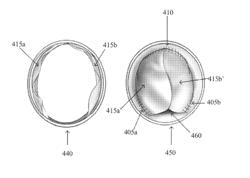 ARTIFICIAL VALVED CONDUITS FOR CARDIAC RECONSTRUCTIVE PROCEDURES AND METHODS FOR THEIR PRODUCTION