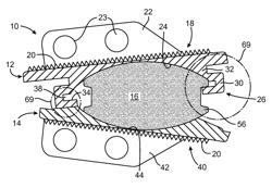 Prosthetic disc for intervertebral insertion