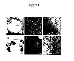 MODALITIES FOR THE TREATMENT OF DEGENERATIVE DISEASES OF THE RETINA