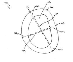 BONE MATRIX COMPOSITIONS AND METHODS