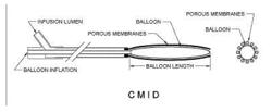 DELIVERY OF MATERIALS INTO MARGINS OF TISSUE CAVITIES