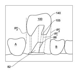 Method and system for providing feedback data useful in prosthodontic procedures associated with the intra oral cavity