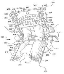 Method for treating a neurological disorder