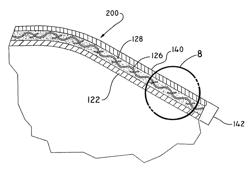 High pressure balloon