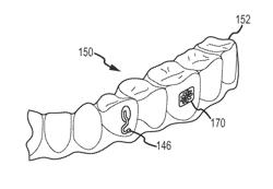 Dental appliance, dental appliance adhesive and related methods and uses