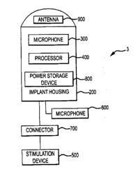 IMPLANTABLE AUDITORY STIMULATION SYSTEM AND METHOD WITH OFFSET IMPLANTED MICROPHONES