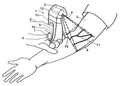 Vial-Mounted Micro Vein Enhancer