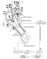 Cardiac function change evaluating device