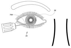 METHODS AND APPARATUS FOR DELIVERING OCULAR IMPLANTS INTO THE EYE