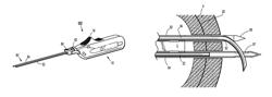 Meniscal repair device