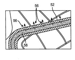 Hollow Stent Filled With A Therapeutic Agent Formulation