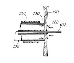 Apparatus and methods to create and maintain an intra-atrial pressure relief opening